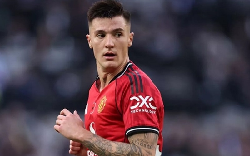 Sesko bị Shearer chỉ trích